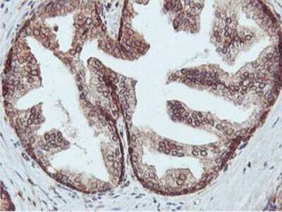 Immunohistochemistry: APMAP Antibody (OTI4F6) - Azide and BSA Free [NBP2-72080]