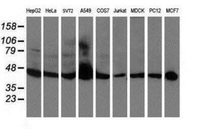 Western Blot: APMAP Antibody (OTI4F6)Azide and BSA Free [NBP2-72080]
