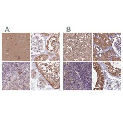 Immunohistochemistry-Paraffin: APOA1BP Antibody [NBP2-30626]
