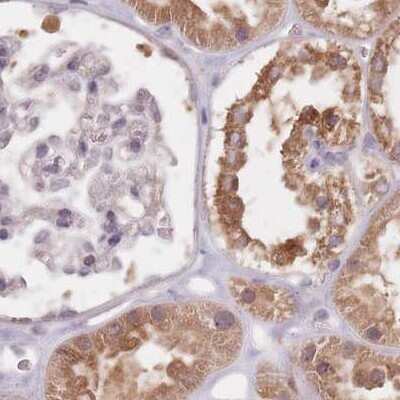 Immunohistochemistry-Paraffin: APOA1BP Antibody [NBP2-30626]