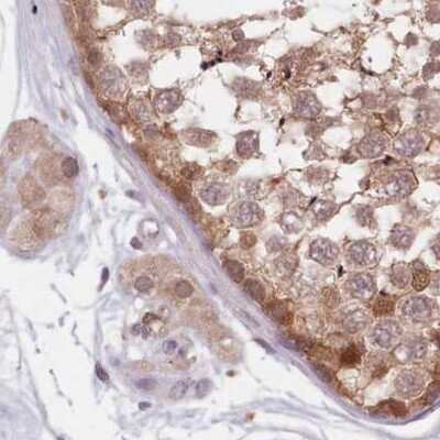 Immunohistochemistry-Paraffin: APOA1BP Antibody [NBP2-30626]