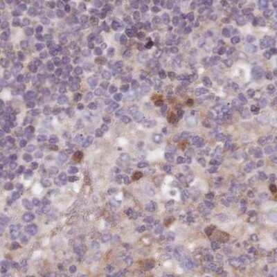 Immunohistochemistry-Paraffin: APOA1BP Antibody [NBP2-30626]