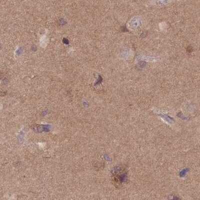 Immunohistochemistry-Paraffin: APOA1BP Antibody [NBP2-30626]