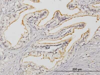 Immunohistochemistry-Paraffin: APOB48R Antibody (2D7) [H00055911-M03]