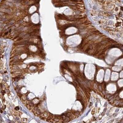 Immunohistochemistry-Paraffin: APOB48R Antibody [NBP1-90129]