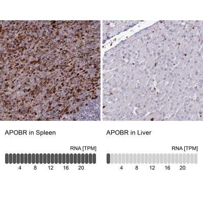 Immunohistochemistry-Paraffin: APOB48R Antibody [NBP1-90130]