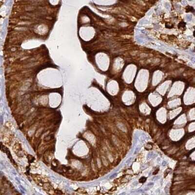 Immunohistochemistry-Paraffin: APOB48R Antibody [NBP1-90130]