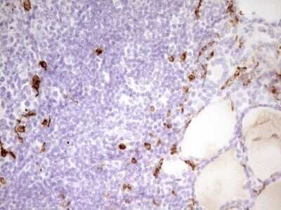 Immunohistochemistry: APOB48R Antibody (OTI1B1) - Azide and BSA Free [NBP2-72052]