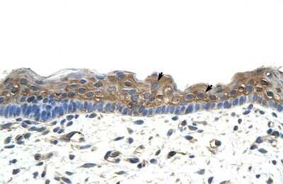 Immunohistochemistry-Paraffin: APOBEC2 Antibody [NBP1-57469]