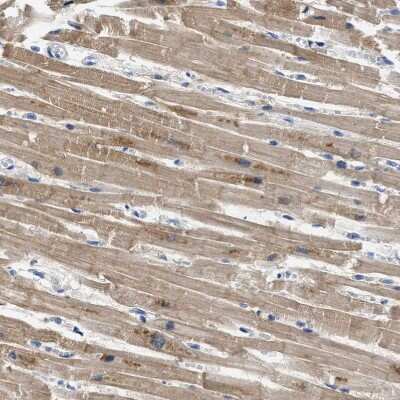 Immunohistochemistry-Paraffin: APOBEC2 Antibody [NBP1-88848]