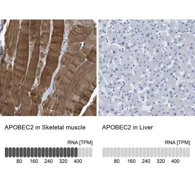 Immunohistochemistry-Paraffin: APOBEC2 Antibody [NBP1-88848]