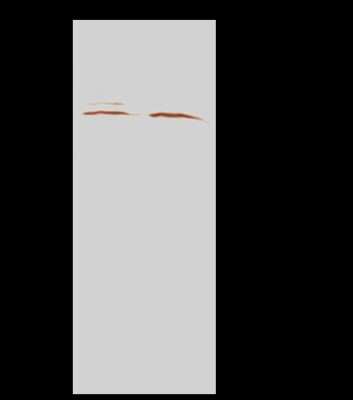 Immunoprecipitation: APOBEC3B Antibody [NBP2-99174]