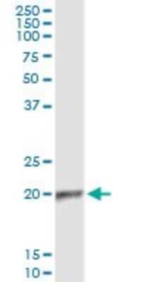 Immunoprecipitation: APOBEC3C Antibody (3E6) [H00027350-M01]
