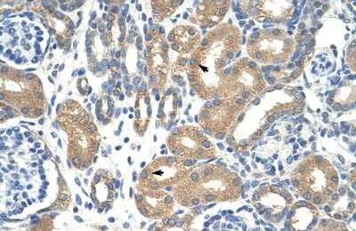 Immunohistochemistry-Paraffin: APOBEC3D Antibody [NBP1-57440]
