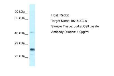 Western Blot: APOBEC3D Antibody [NBP2-84444]