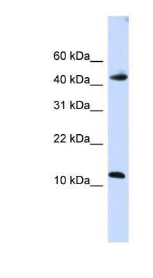 Western Blot: APOBEC3F Antibody [NBP1-57515]