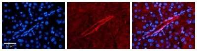 Immunohistochemistry: APOBEC3G Antibody [NBP1-58955]