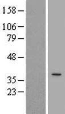 Western Blot: APOL3 Overexpression Lysate [NBP2-09919]