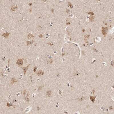 Immunohistochemistry-Paraffin: APOL6 Antibody [NBP1-89031]
