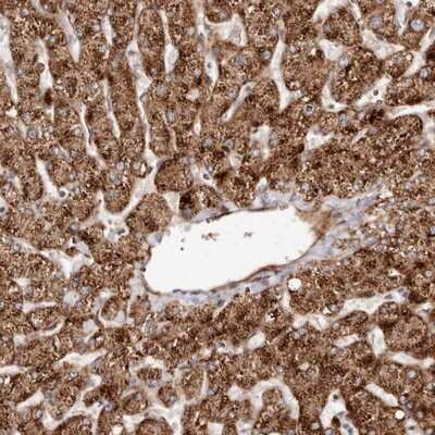 Immunohistochemistry-Paraffin: APOL6 Antibody [NBP1-89032]