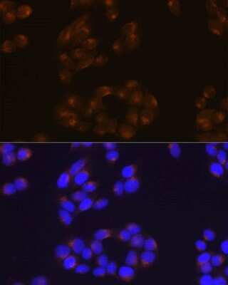 Immunocytochemistry/ Immunofluorescence: APP Antibody (3A8S2) [NBP3-15560]