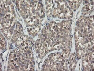 Immunohistochemistry: APP Antibody (OTI4C9) [NBP2-46535]