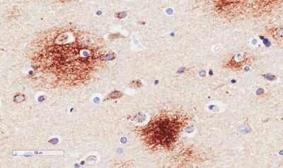 Immunohistochemistry-Paraffin: APP Antibody (6E10) - Chimeric - Azide and BSA Free [NBP2-62566]