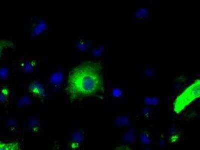 Immunocytochemistry/ Immunofluorescence: APP Antibody (OTI7G9) [NBP2-02358]