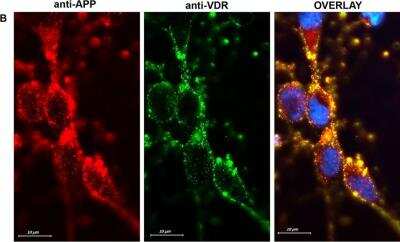 Immunocytochemistry/ Immunofluorescence: APP Antibody [NB300-308]