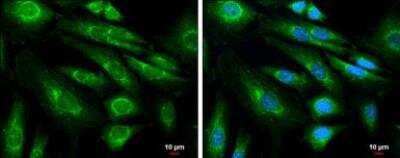 Immunocytochemistry/ Immunofluorescence: APP Antibody [NBP1-32081]
