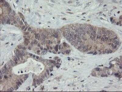 Immunohistochemistry: APP Antibody (OTI4C9) - Azide and BSA Free [NBP2-70197]