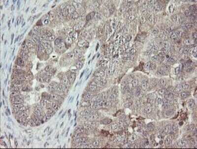 Immunohistochemistry: APP Antibody (OTI4C9) - Azide and BSA Free [NBP2-70197]