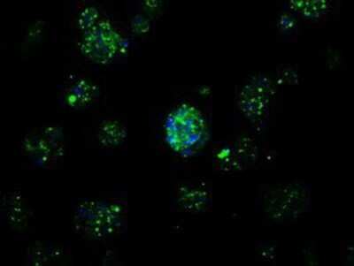Immunocytochemistry/ Immunofluorescence: APP Antibody (OTI7G9) - Azide and BSA Free [NBP2-70187]