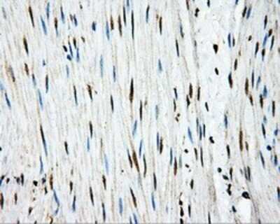 Immunohistochemistry: APP Antibody (OTI7G9) - Azide and BSA Free [NBP2-70187]