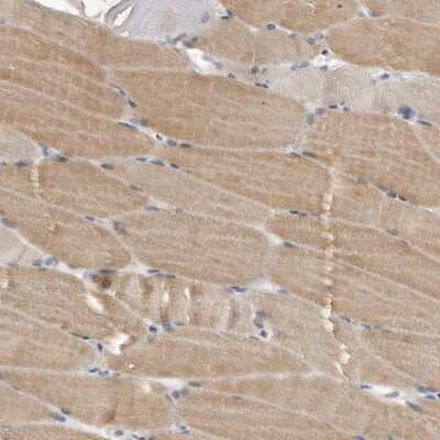 Immunohistochemistry-Paraffin: APPD Antibody [NBP1-90124]