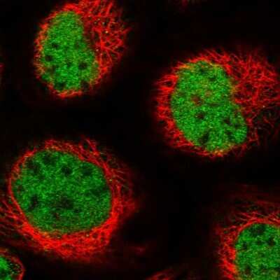 Immunocytochemistry/ Immunofluorescence: APRIN Antibody [NBP1-90122]