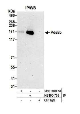 Immunoprecipitation: APRIN Antibody [NB100-755]