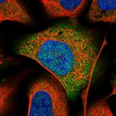 Immunocytochemistry/ Immunofluorescence: APRT Antibody [NBP1-89519]