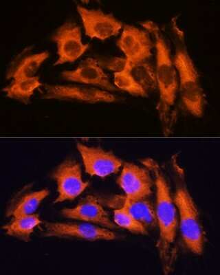 Immunocytochemistry/ Immunofluorescence: APRT Antibody - BSA Free [NBP2-92731]