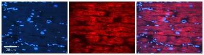 Immunohistochemistry: APRT Antibody [NBP1-55300]