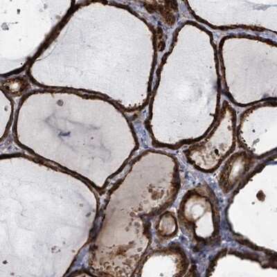 Immunohistochemistry-Paraffin: APXL Antibody [NBP2-13308]