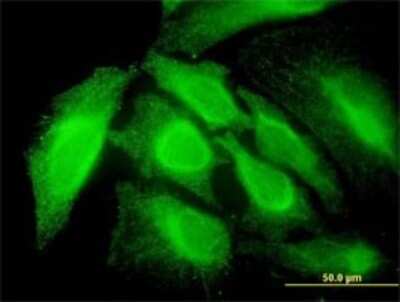 Immunocytochemistry/ Immunofluorescence: ARA54 Antibody (4G9) [H00009604-M01]