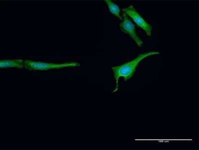 Immunocytochemistry/ Immunofluorescence: ARA54 Antibody [H00009604-D01P]