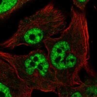 Immunocytochemistry/ Immunofluorescence: ARA54 Antibody [NBP3-17686]