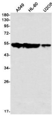 Western Blot: ARA54 Antibody (S01-1H7) [NBP3-20001]