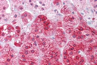 Immunohistochemistry-Paraffin: ARC/ARG3.1 Antibody [NBP1-56929]