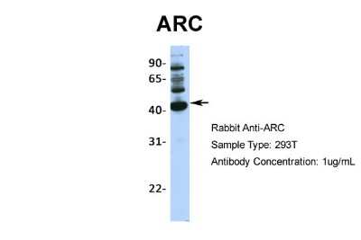 Western Blot: ARC/ARG3.1 Antibody [NBP1-56929]