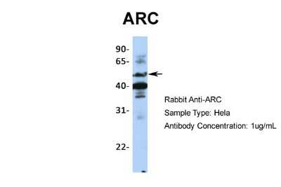 Western Blot: ARC/ARG3.1 Antibody [NBP1-56929]