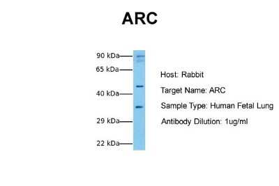 Western Blot: ARC/ARG3.1 Antibody [NBP1-56929]