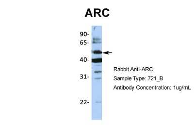 Western Blot: ARC/ARG3.1 Antibody [NBP1-56929]